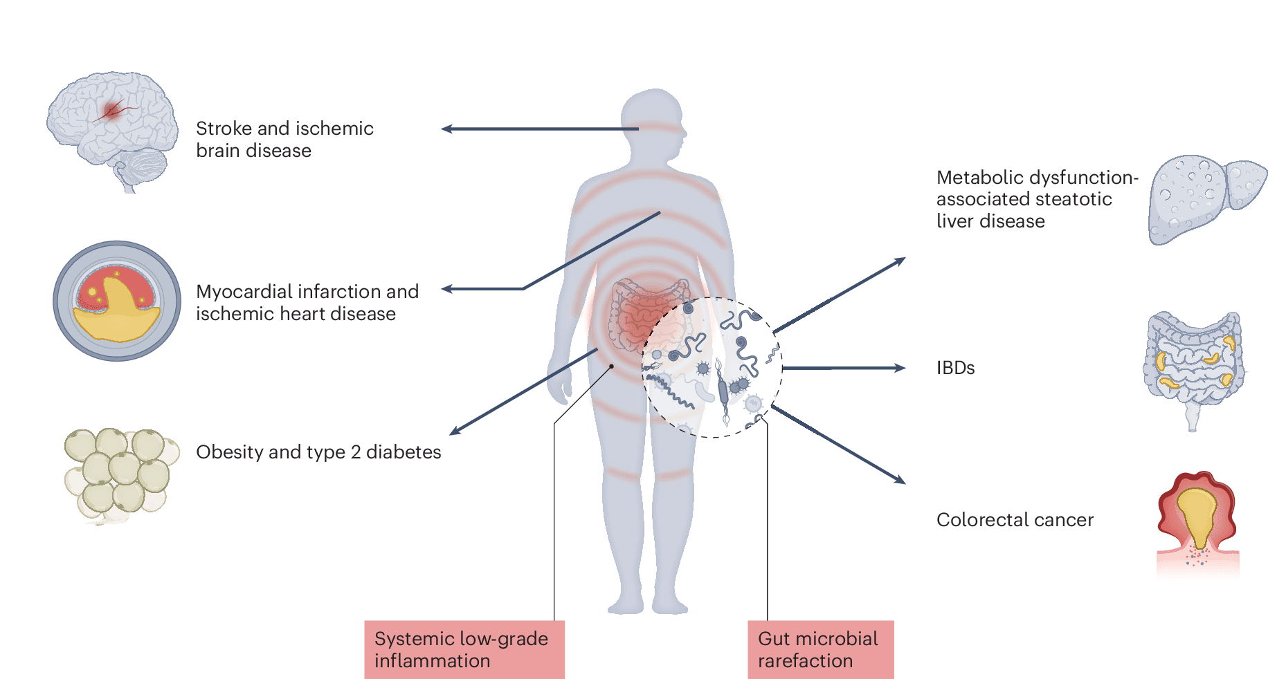 Gut health habits that actually work in midlife 2026